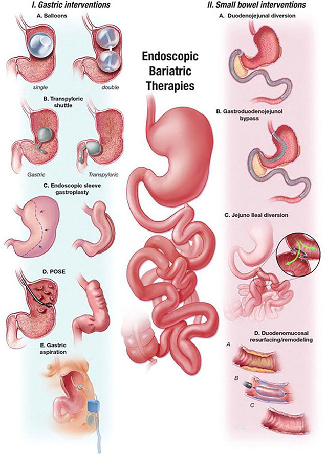 Diğer Metabolik Tedavi Teknikleri