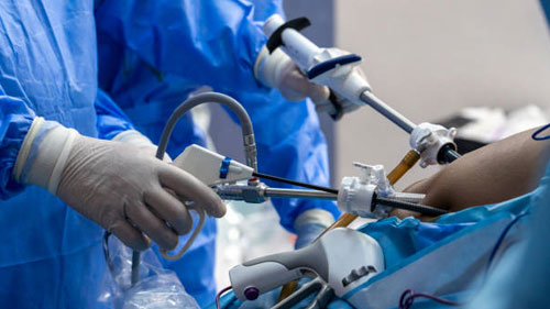 Safra Kesesi Ameliyatı