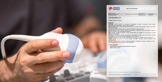 Üst Abdomen USG Bulguları ve Ultrason Raporu Ne Diyor?